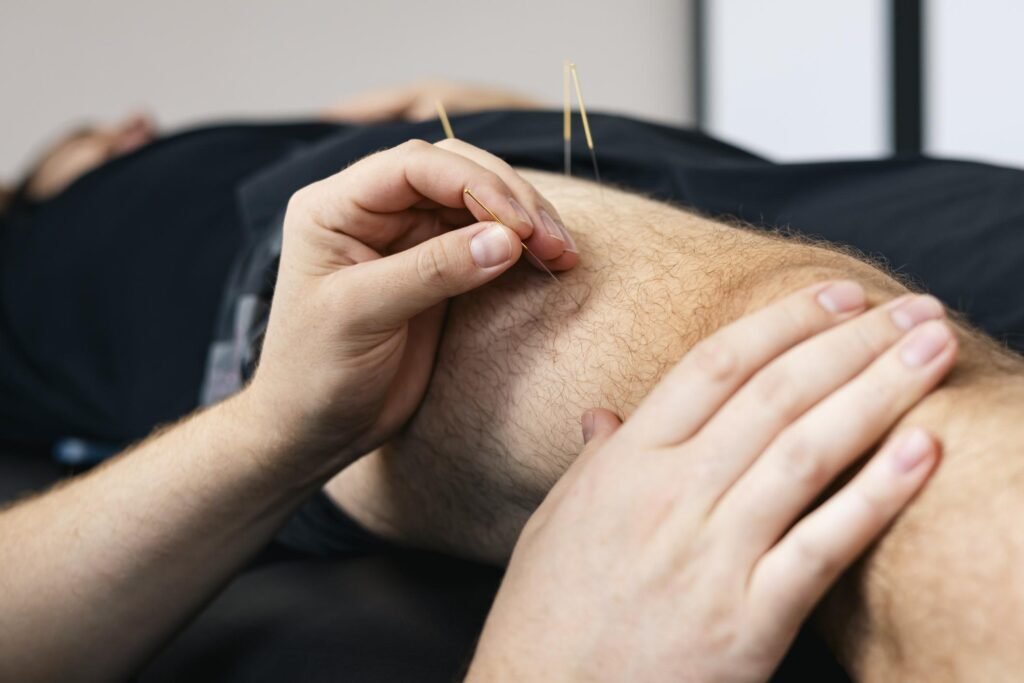 dry-needling